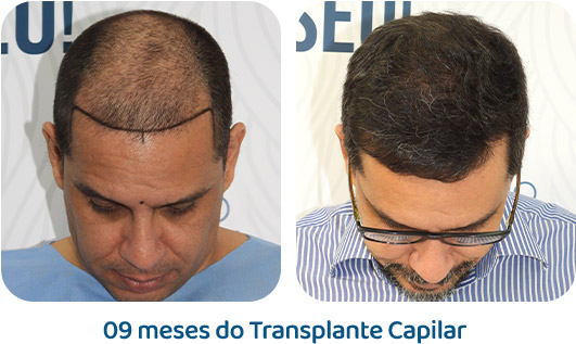 Masculino resultado 68