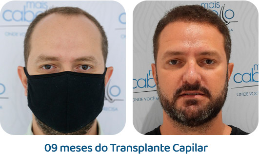 Masculino resultado 70