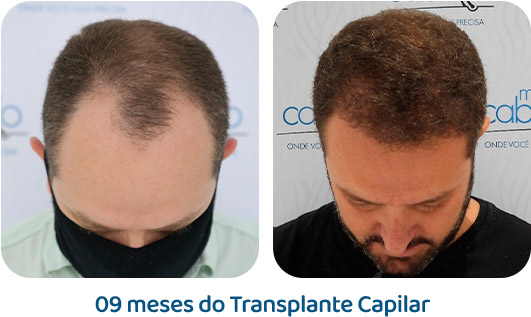 Masculino resultado 71