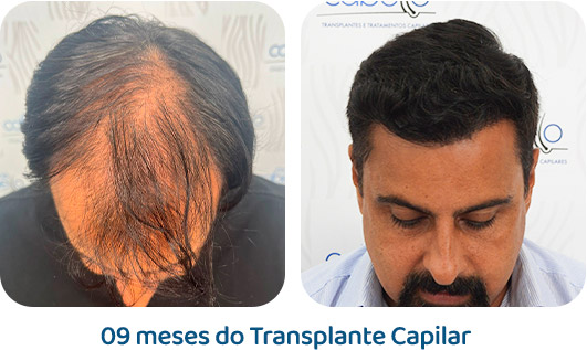 Masculino resultado 72
