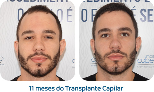Masculino resultado 73