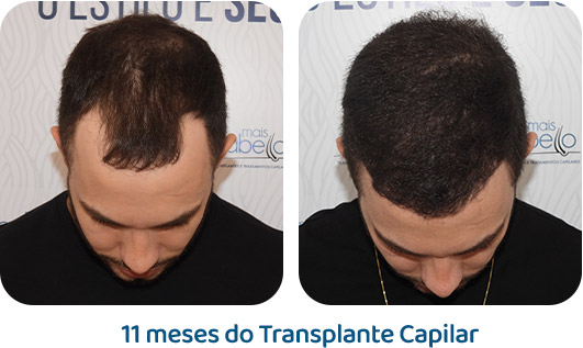 Masculino resultado 74