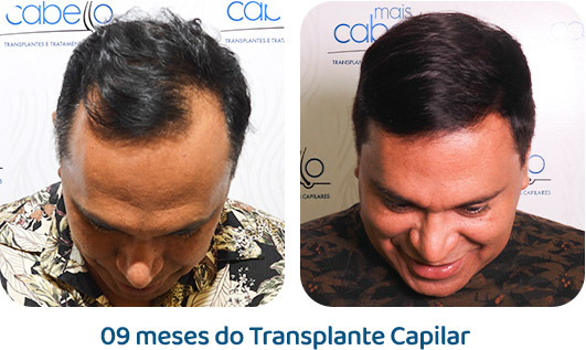 Masculino resultado 75
