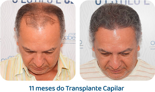 Masculino resultado 76