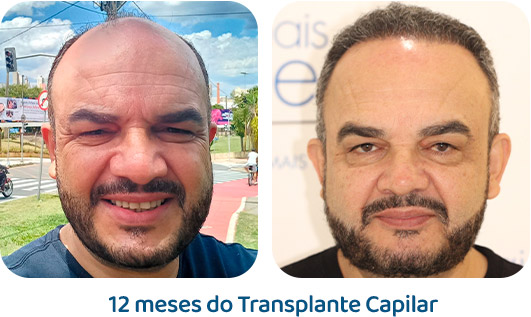 Masculino resultado 77