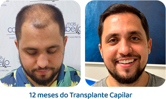 Masculino resultado 78