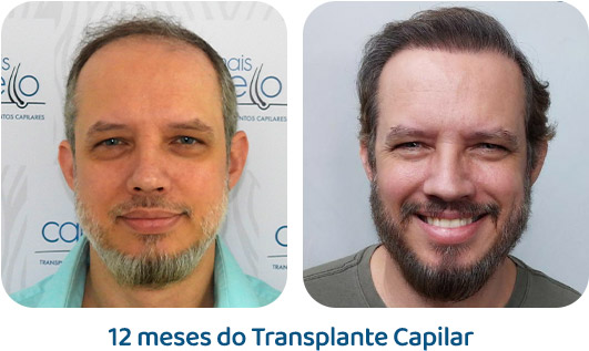 Masculino resultado 79
