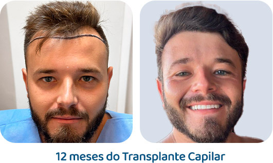 Masculino resultado 80