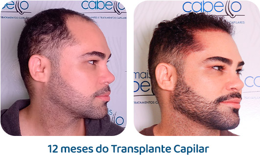 Masculino resultado 81