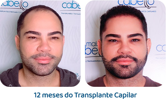 Masculino resultado 82