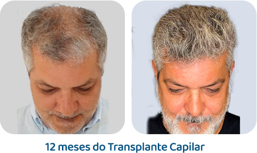 Masculino resultado 83