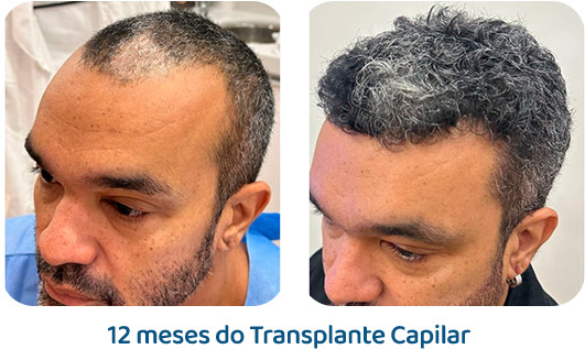 Masculino resultado 84
