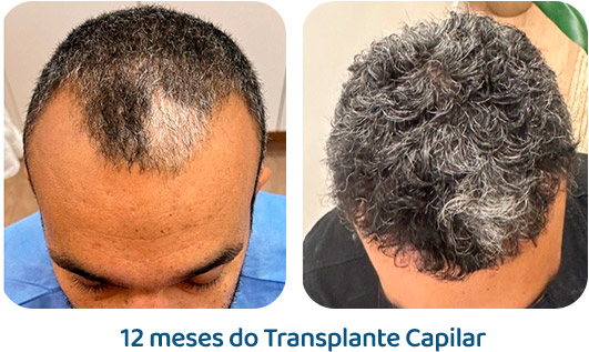 Masculino resultado 85
