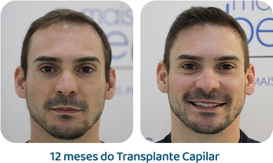 Masculino resultado 86