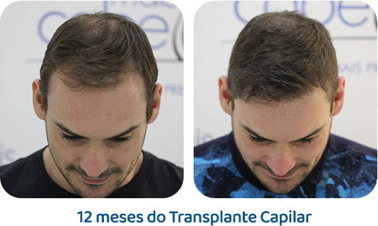 Masculino resultado 87