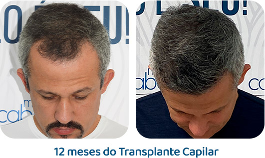 Masculino resultado 90