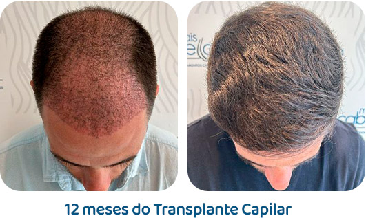 Masculino resultado 91