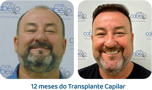Masculino resultado 93