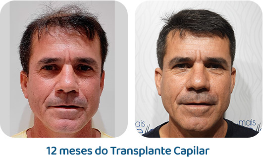 Masculino resultado 94