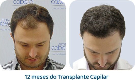 Masculino resultado 95