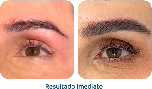 Sobrancelhas Everbrow resultado 1