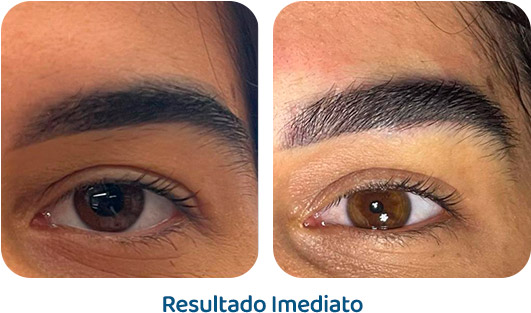 Sobrancelhas Everbrow resultado 5