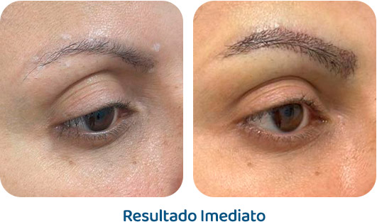 Sobrancelhas Everbrow resultado 6