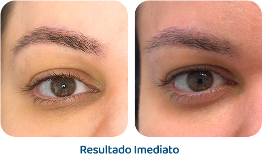 Sobrancelhas Everbrow resultado 8