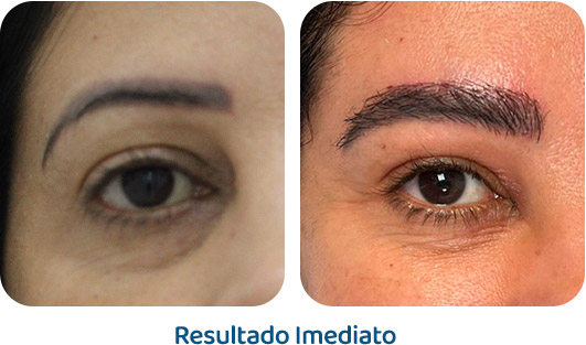 Sobrancelhas Everbrow resultado 10