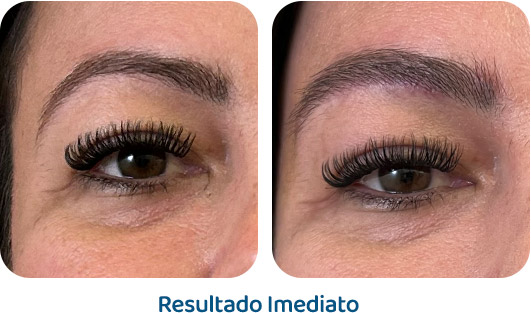 Sobrancelhas Everbrow resultado 13