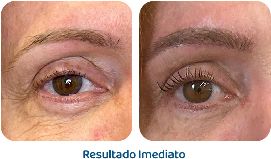 Sobrancelhas Everbrow resultado 14